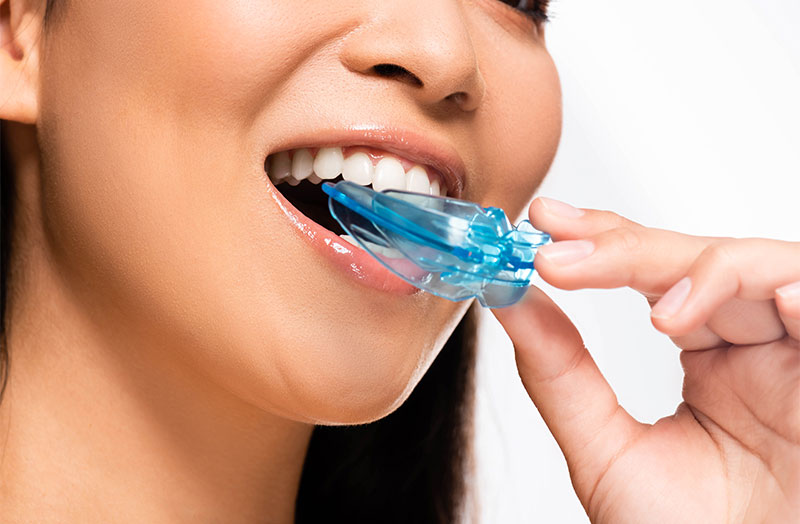 Under Armour® Mouthguards at Ramani Dentistry in South Lyon, MI