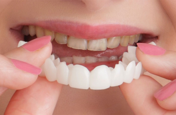 Snap-on Smile® at Ramani Dentistry in South Lyon, MI