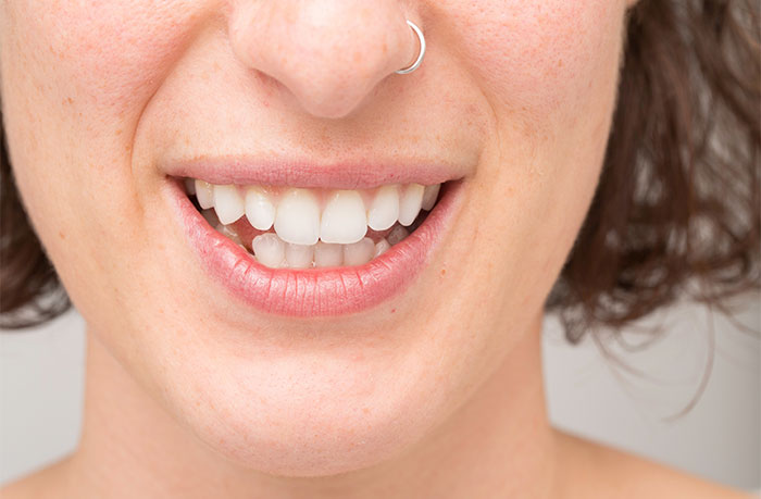 Occlusal Disease at Ramani Dentistry in South Lyon, MI